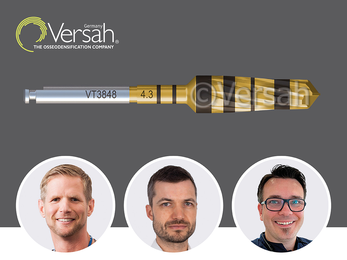 Versah® Osseodensification Erfahrungsaustausch