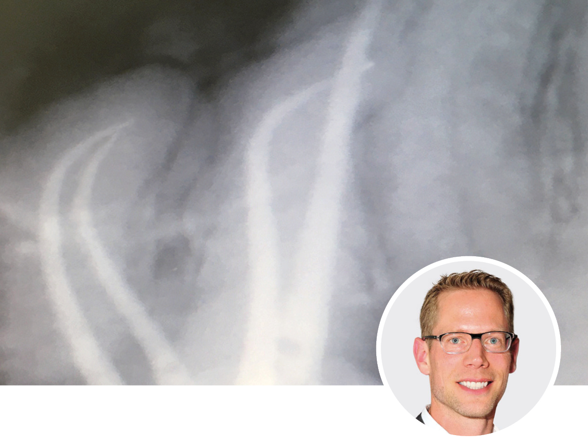 Moderne Endodontie: Einfach, effizient zu guten Ergebnissen