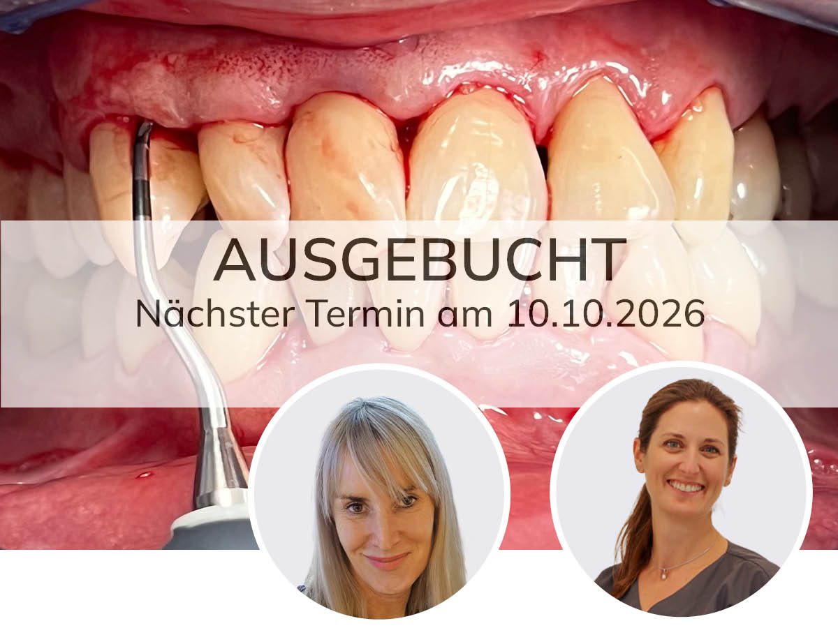 Parodontitis und ihre Wechselwirkungen