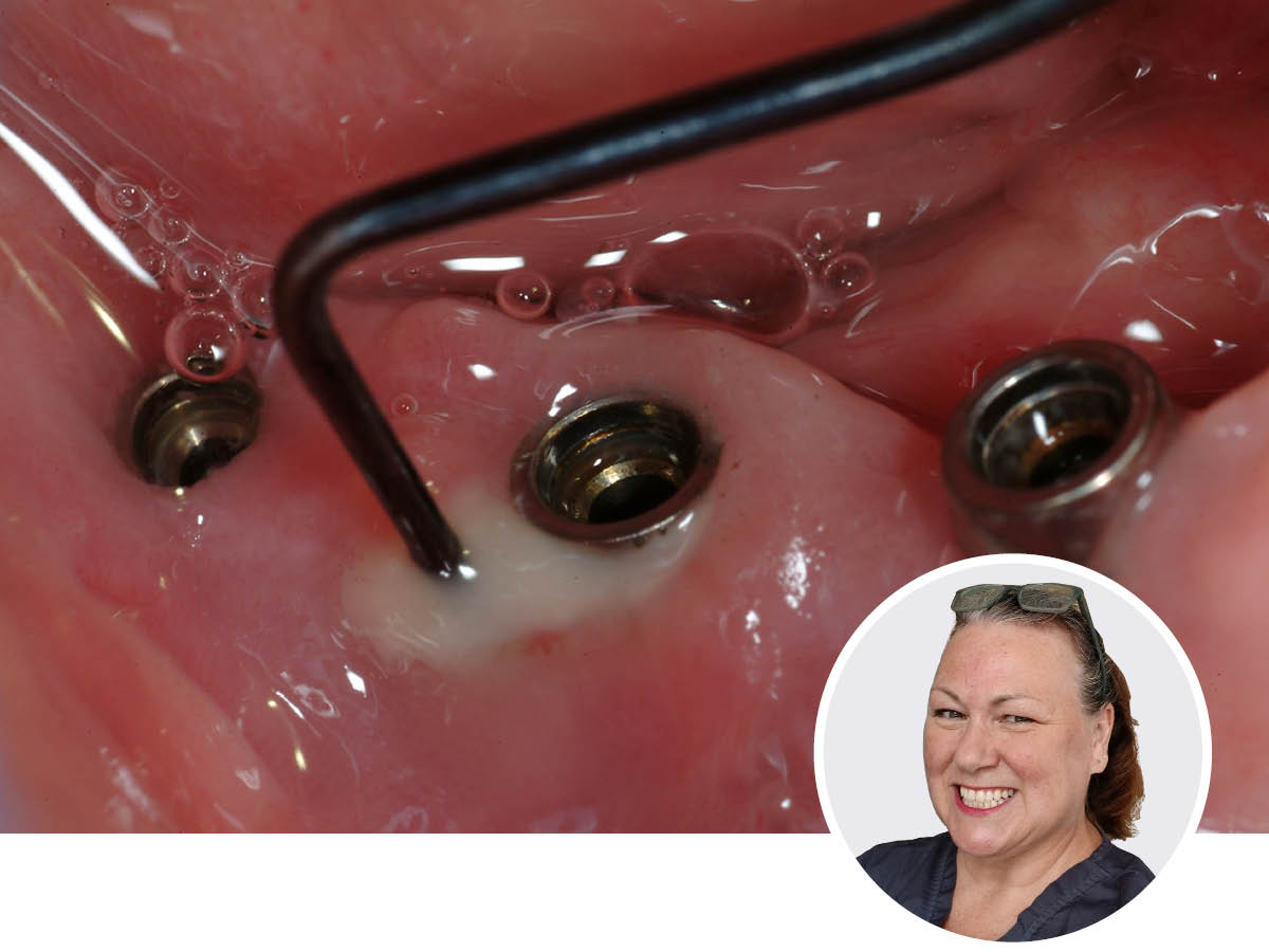 Periimplantäre Gesundheit professionell gestalten | 09.05.2026 | München