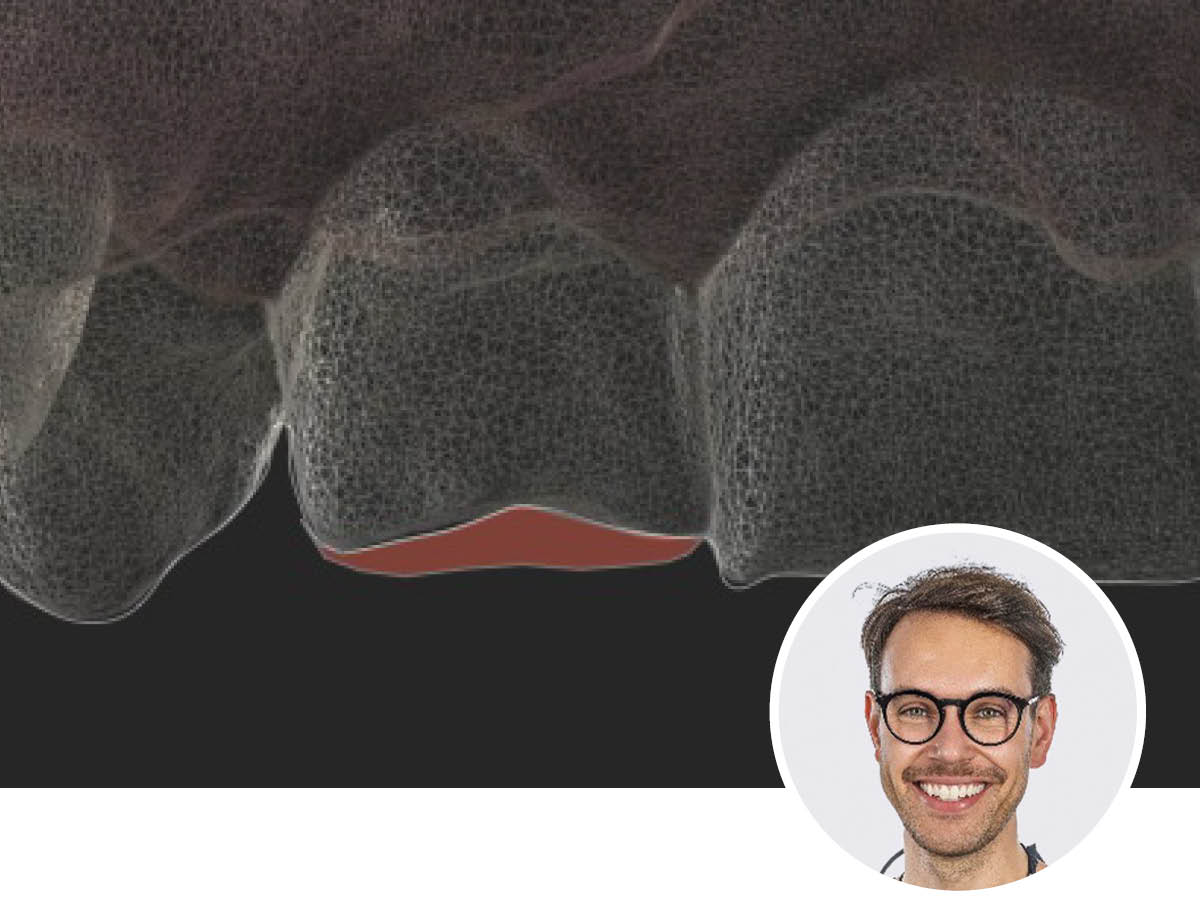 Zahntechnik im 4D-Zeitalter
