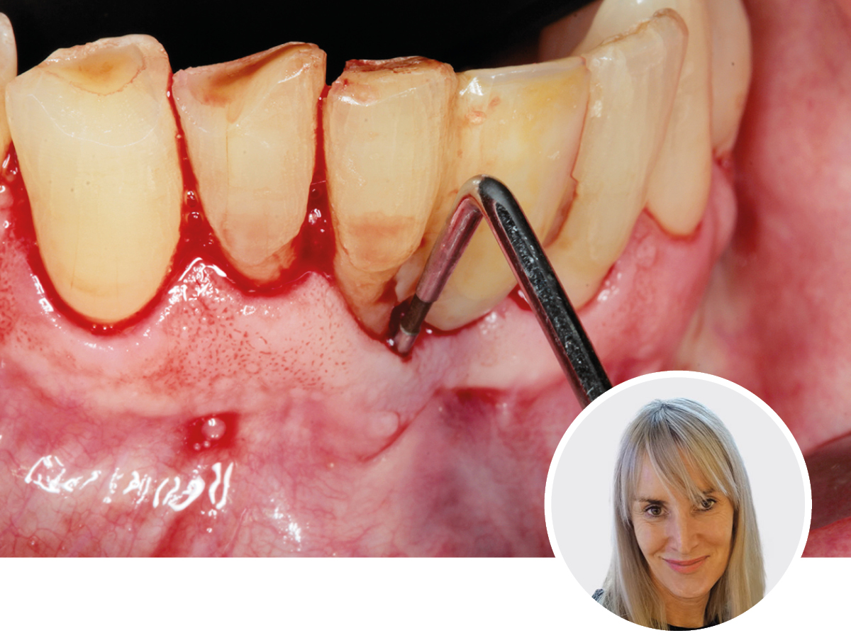 Keine Angst vor Risikopatienten | 08.11.2025 | Köln