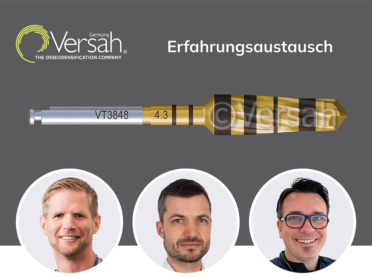Versah® Osseodensification Erfahrungsaustausch
