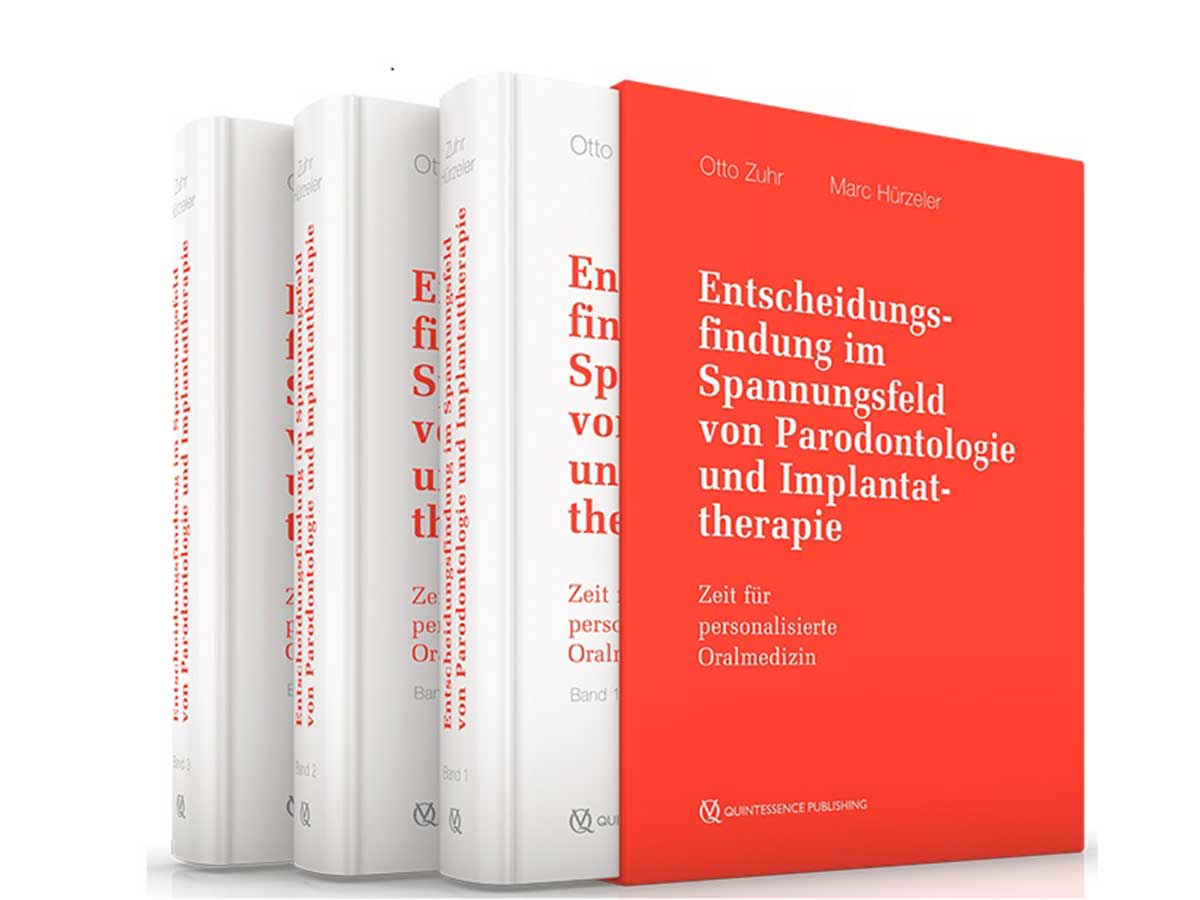 Buch Zuhr/ Hürzeler Entscheidungsfindung im Spannungsfeld von Parodontologie & Implanttherapie
