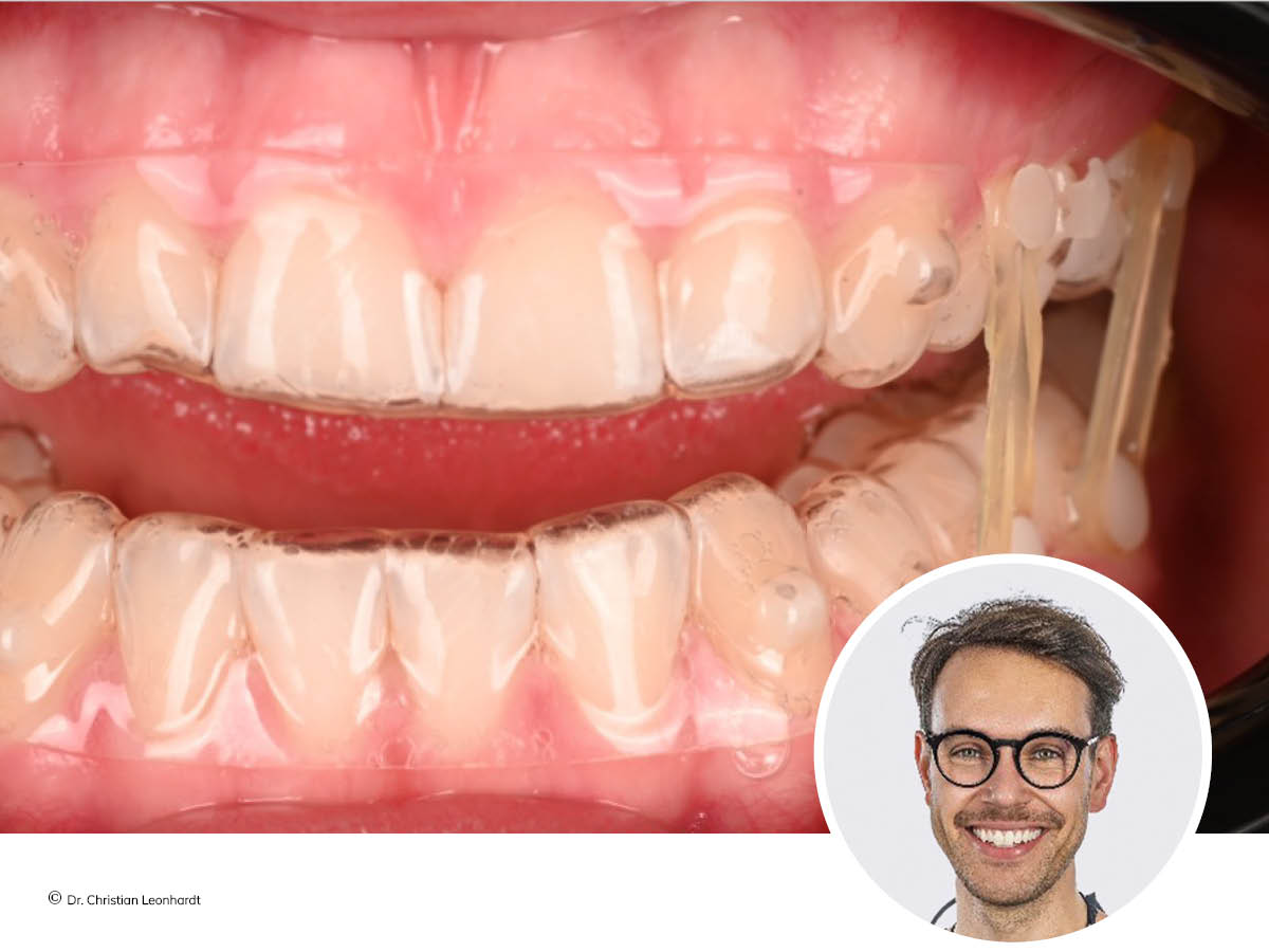 KFO neu gedacht - funktionellen Therapie mit MODJAW