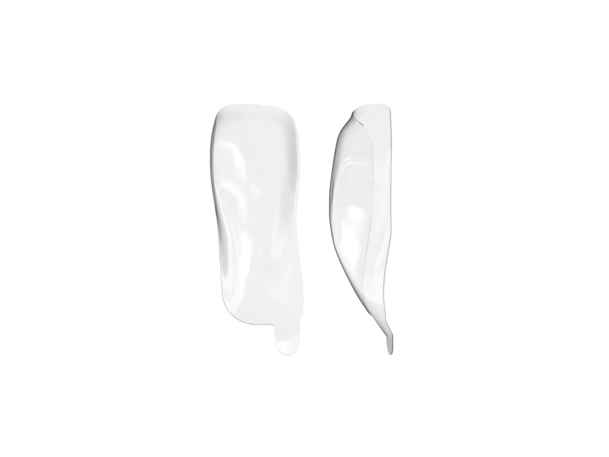 HD Anterior Matrix A-series Shapes 75µ A102 - Upper Distal (50)