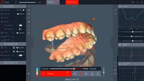 Modjaw Extra Advanced Lizenz 1 Jahr