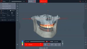 Modjaw Aesthetik Lizenzverlängerung 1 Jahr