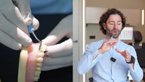 Deppeler Kit Von Sontagh