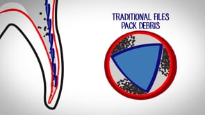 XP-endo Rise Shaper 30/.04 - 25 mm (6)